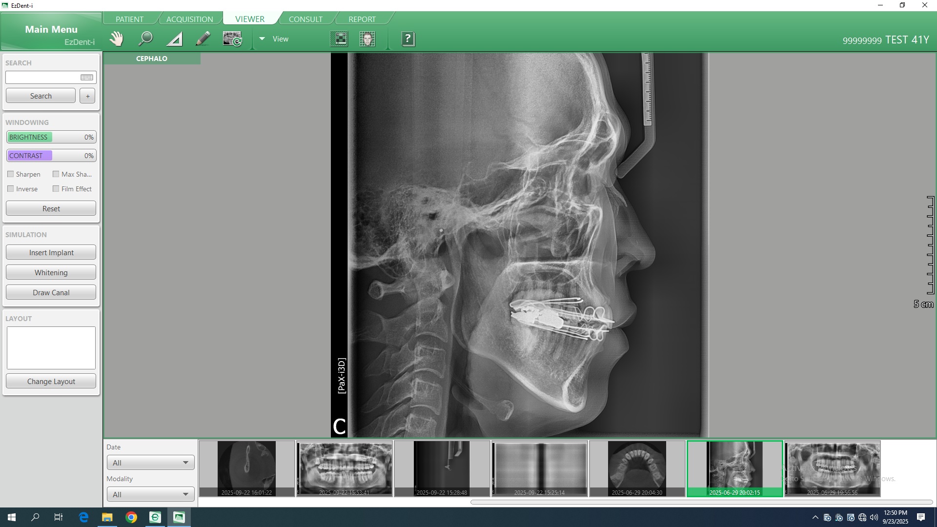 Ortopantógrafo Digital 3D PaX-i3D